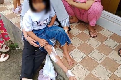 Korban gigitan monyet liar yang lepas dari kandang hewan BPBD Kabupaten Tangerang, Sabtu (12/04/2025). AGH/IDBanten.